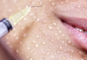 три кита мезотерапии