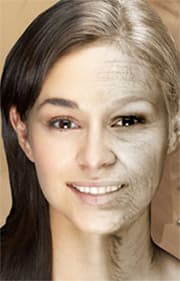 Омоложение по-украински